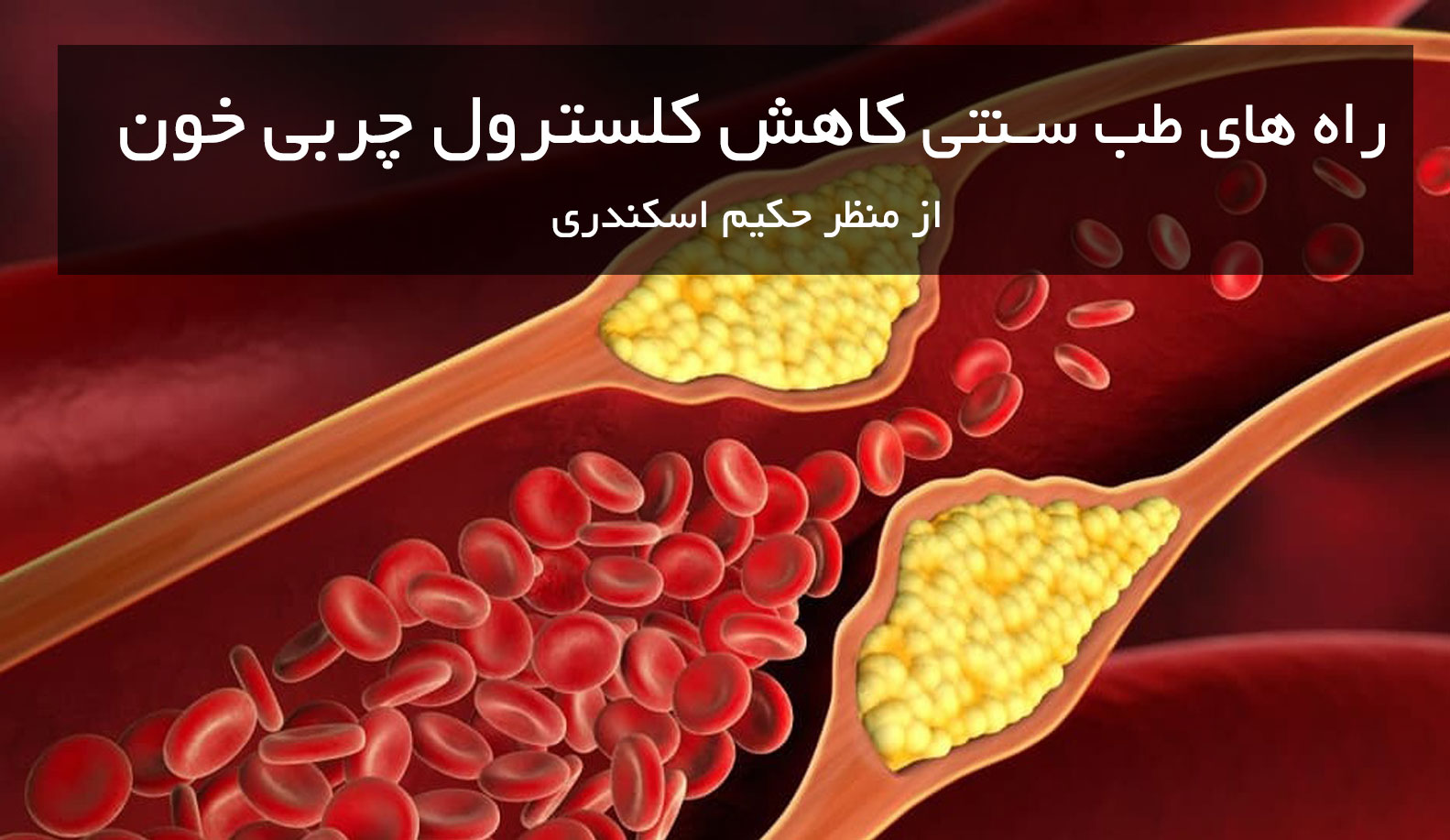 کاهش کلسترول چربی خون در طب سنتی