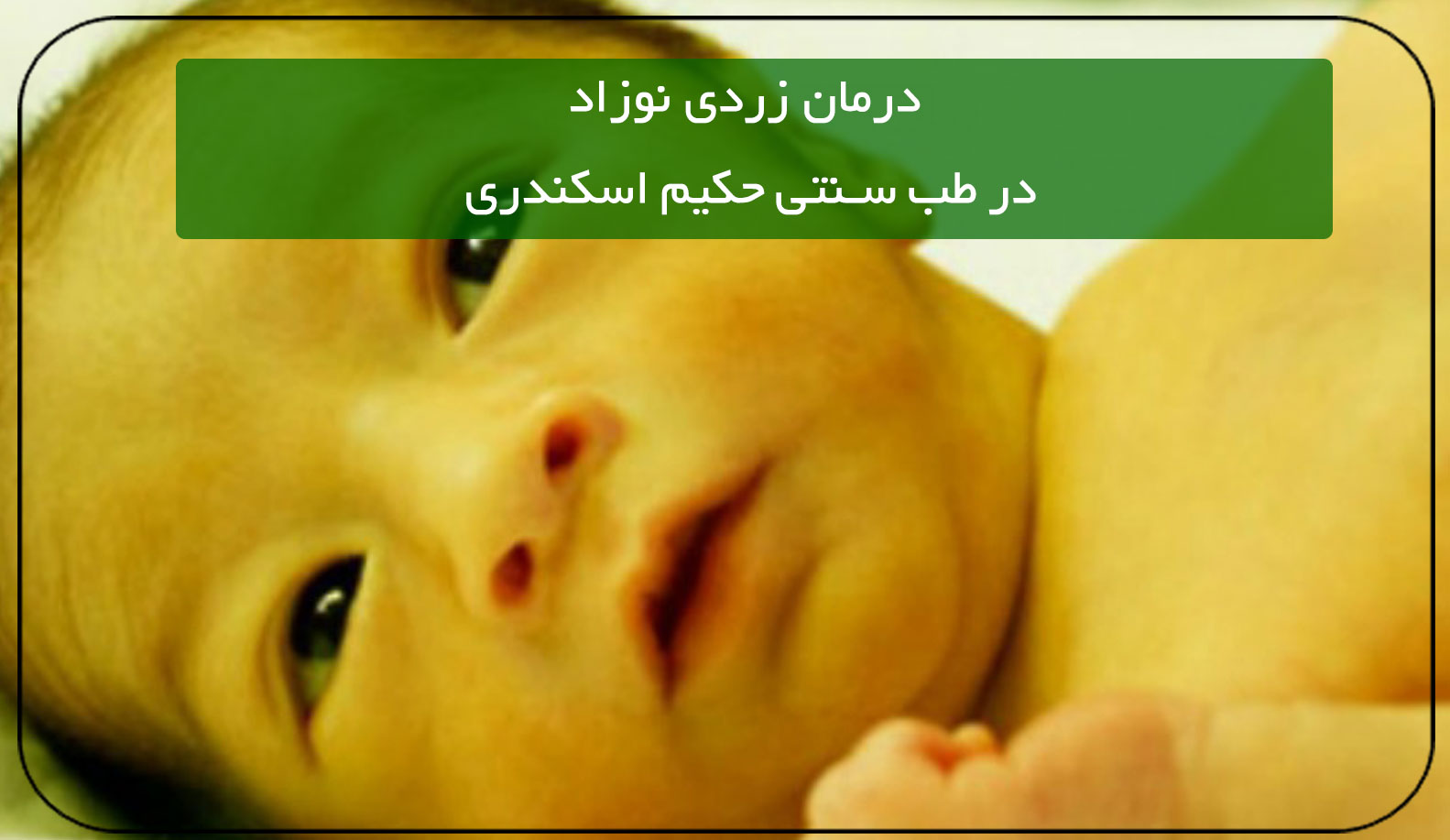 درمان زردی نوزاد در طب سنتی حکیم اسکندری