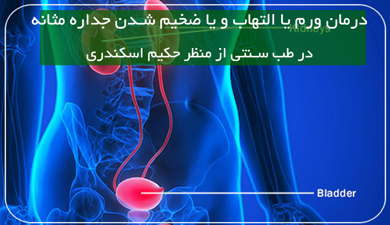 درمان ورم یا التهاب و یا ضخیم شدن جداره مثانه در طب سنتی حکیم اسکندری