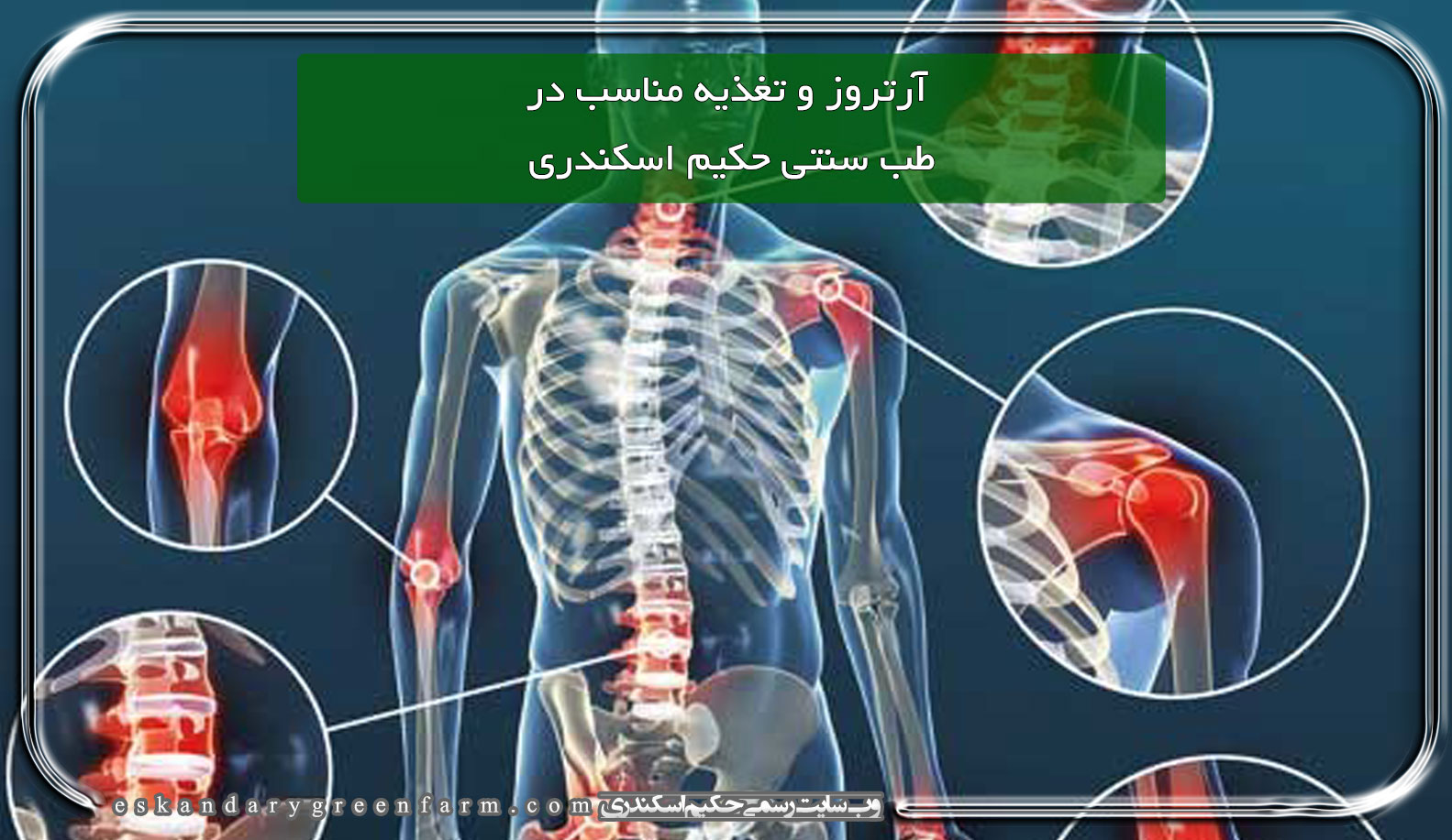 آرتروز و تغذیه مناسب در طب سنتی حکیم اسکندری