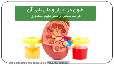 خون در ادرار ، مشکلات کلیوی