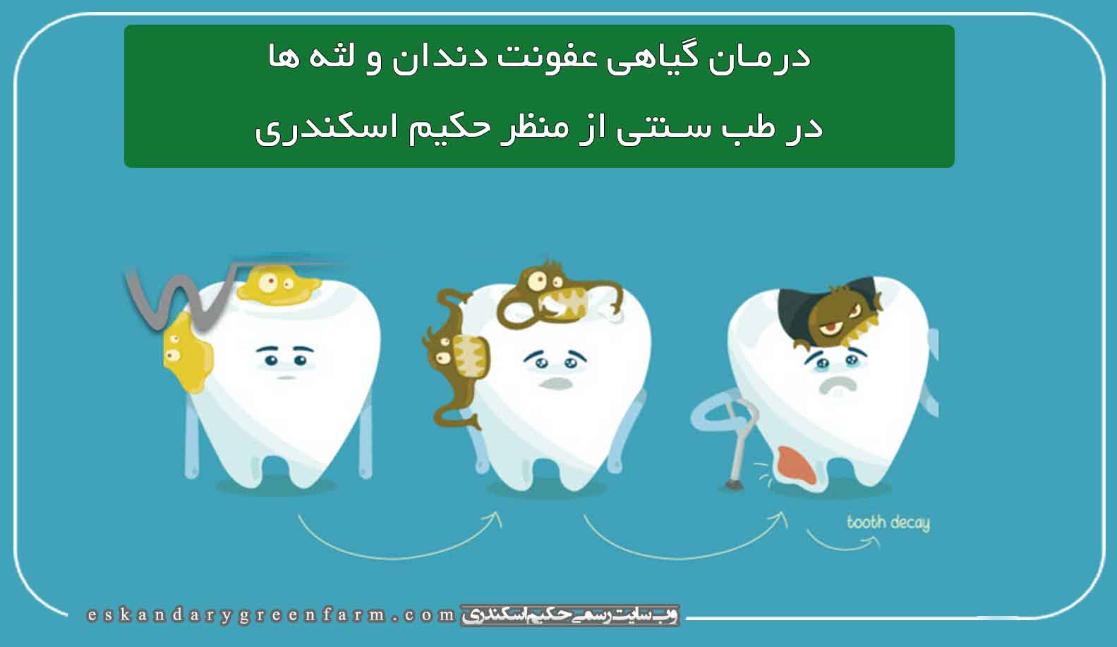 درمان گیاهی عفونت دندان و لثه ها در طب سنتی