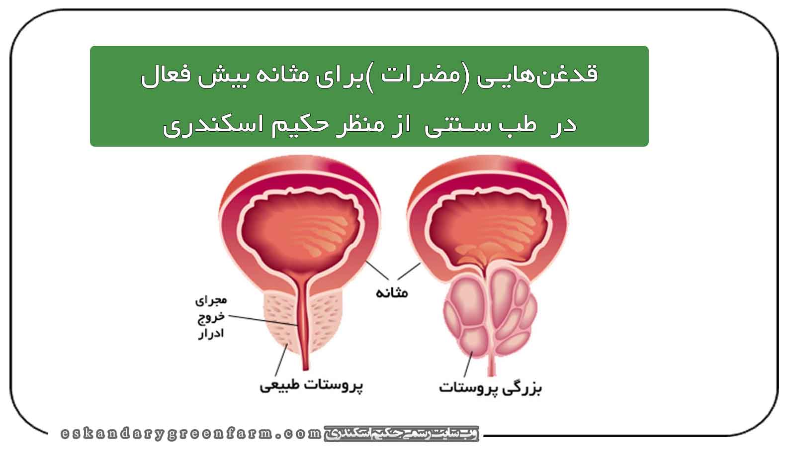 نسخه گیاهی درمان بیماریها در طب سنتی حکیم اسکندری | مزرعه سبز اسکندری