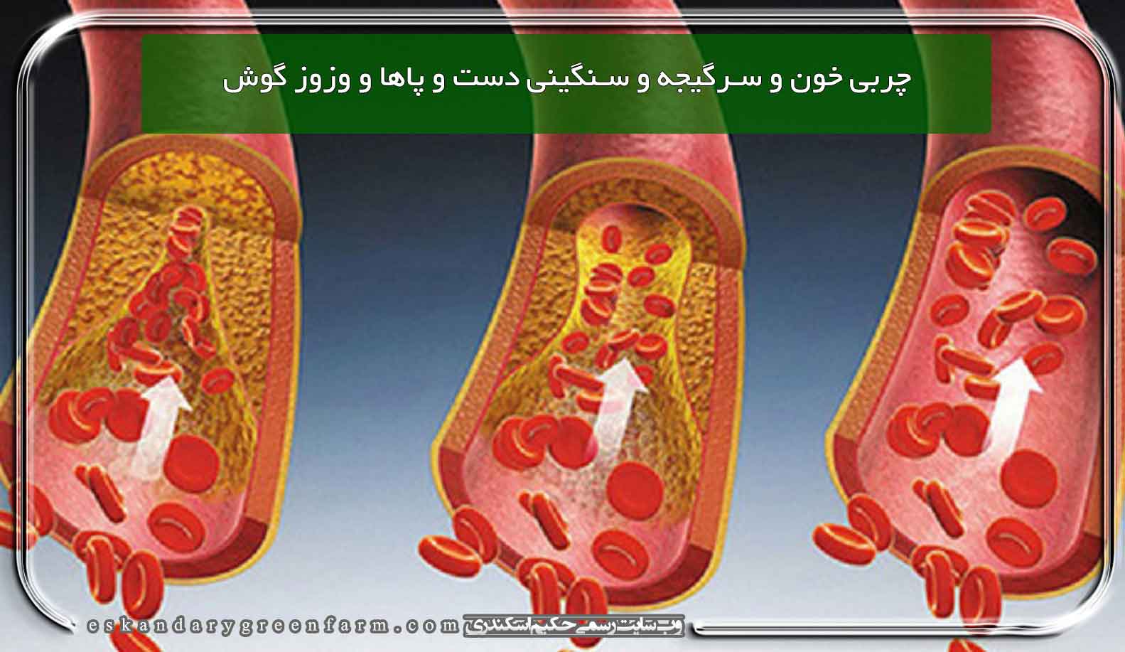 چربی خون و سرگیجه و سنگینی دست و پاها و وزوز گوش