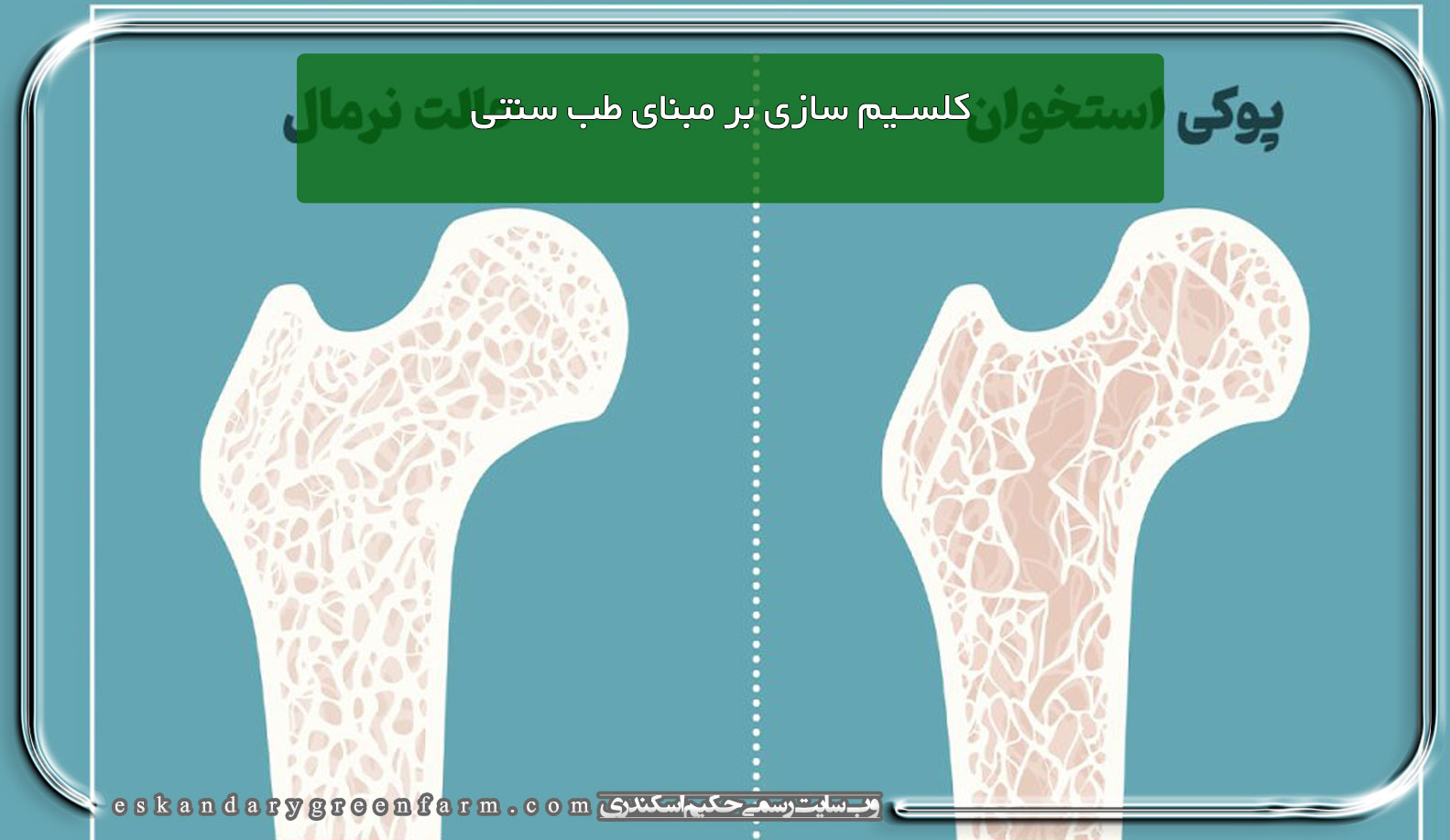 کلسیم سازی بر مبنای طب سنتی